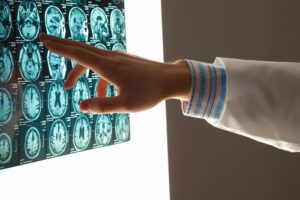 Types of Colorado Springs, CO Catastrophic Injury Lawyer Cases We Handle