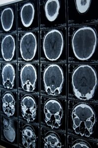 brain injury lawyer in Pueblo, CO