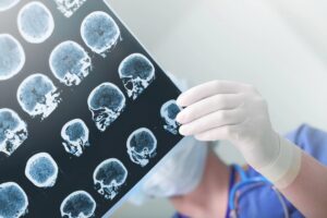 TBI Lawyer in Colorado Springs, CO